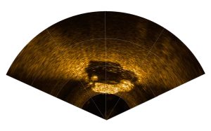 Imaging Sonar Technology
